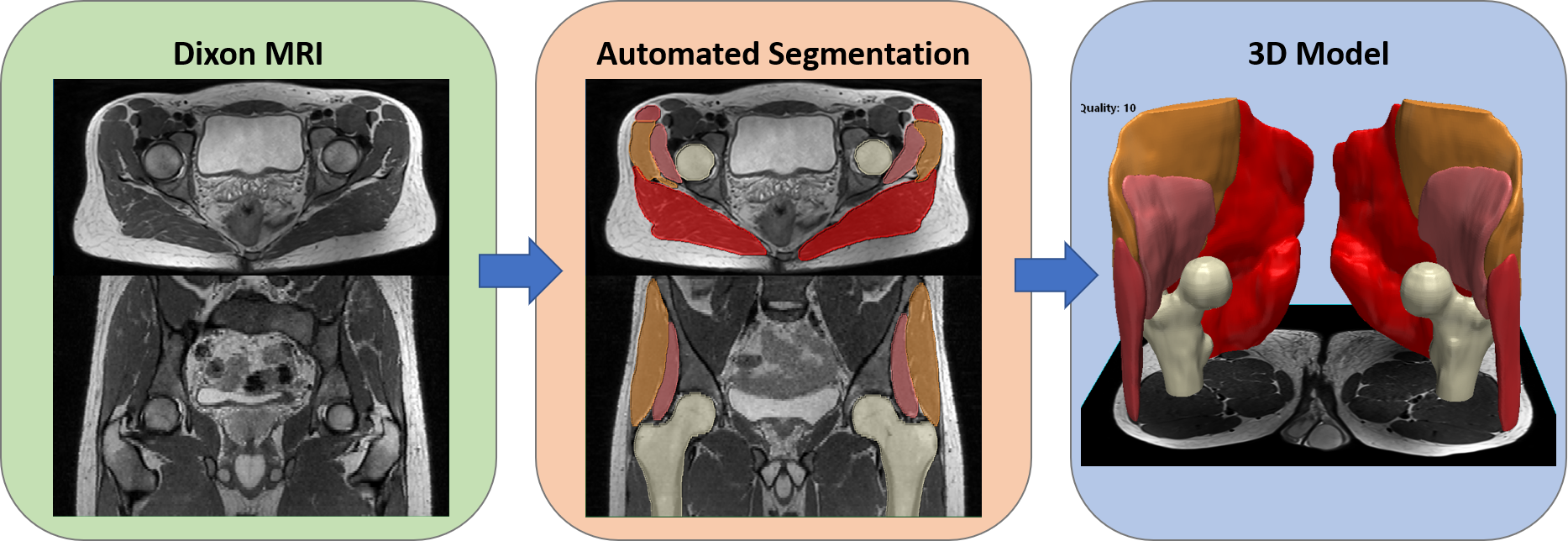 Muscle Segmentation